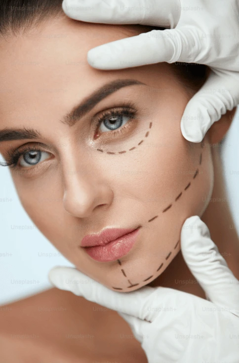 Cirujano con guantes blancos enmarcando el rostro de una paciente con líneas de marcación preoperatoria, consulta de cirugía plástica facial con el Dr. Leopoldo Navarro