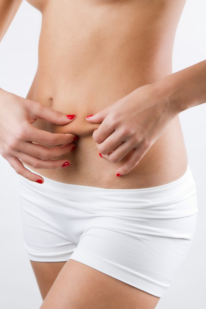 Mujer pellizcando el exceso de piel en la zona abdominal baja, imagen ilustrativa de la problemática que trata la abdominoplastia