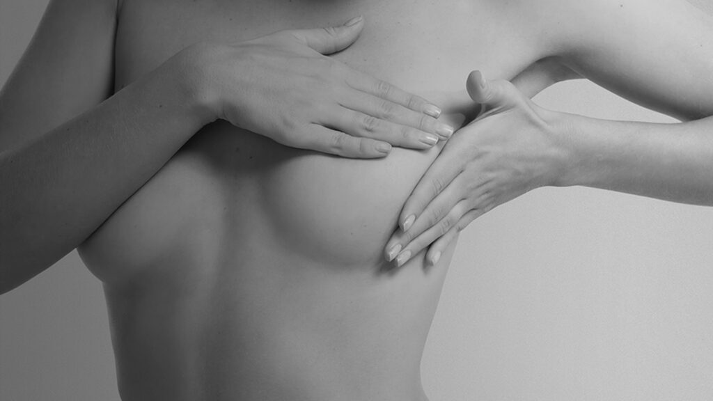 Imagen artística en blanco y negro de manos sosteniendo el pecho femenino, vinculada a cirugía mamaria estética